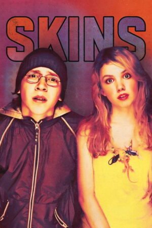 Skins